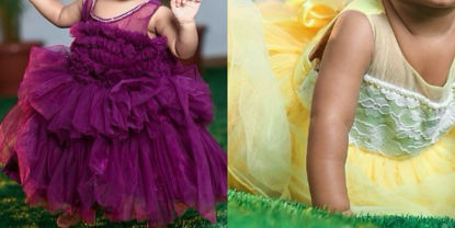 Picture of Combo of Yellow and Burgundy Baby Frocks For 1Y